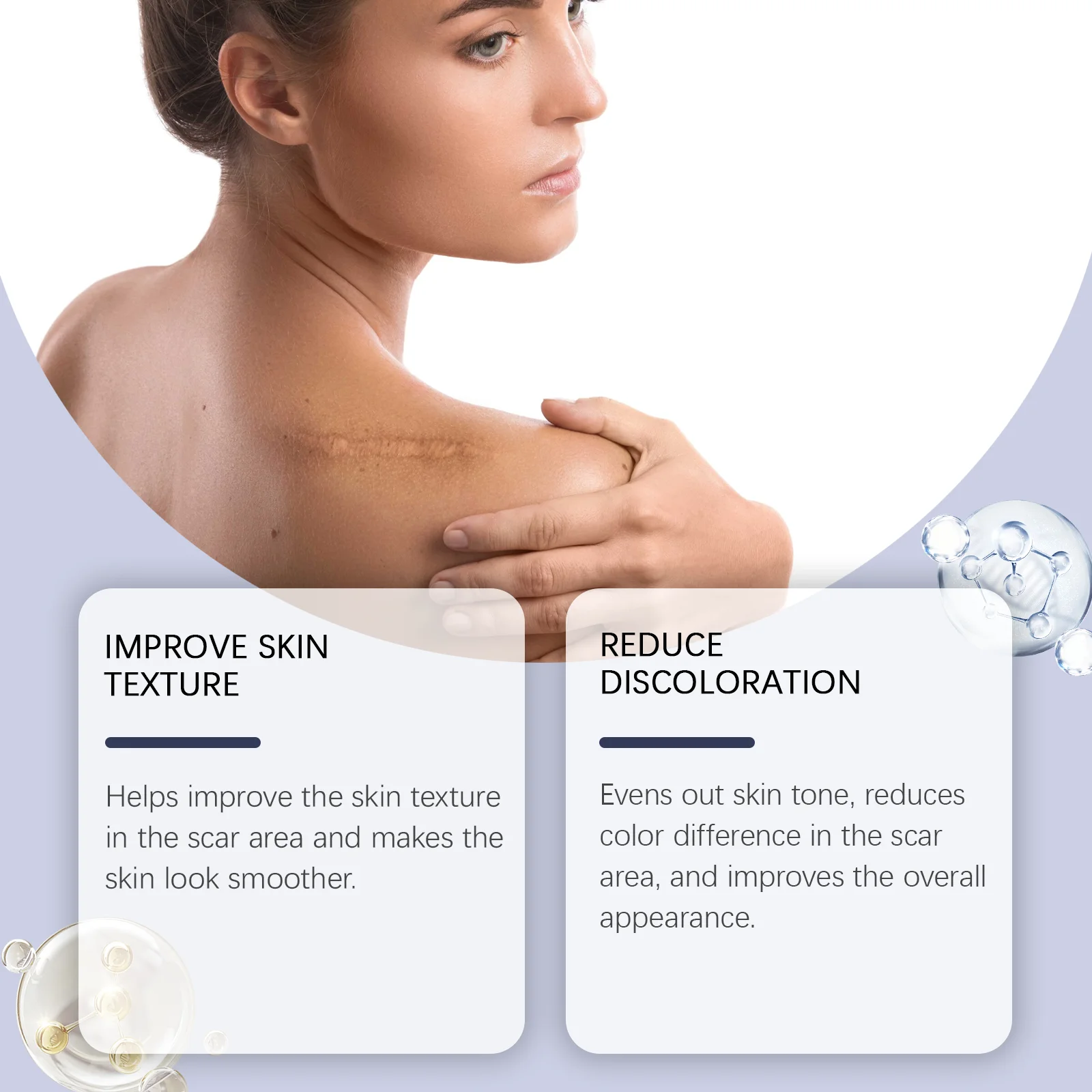 Scar Repair Cream For Stretch Marks Burns Surgical Scars Fade Acne Marks Old New Scar Recovery Moisturizing Gentle Skin Care