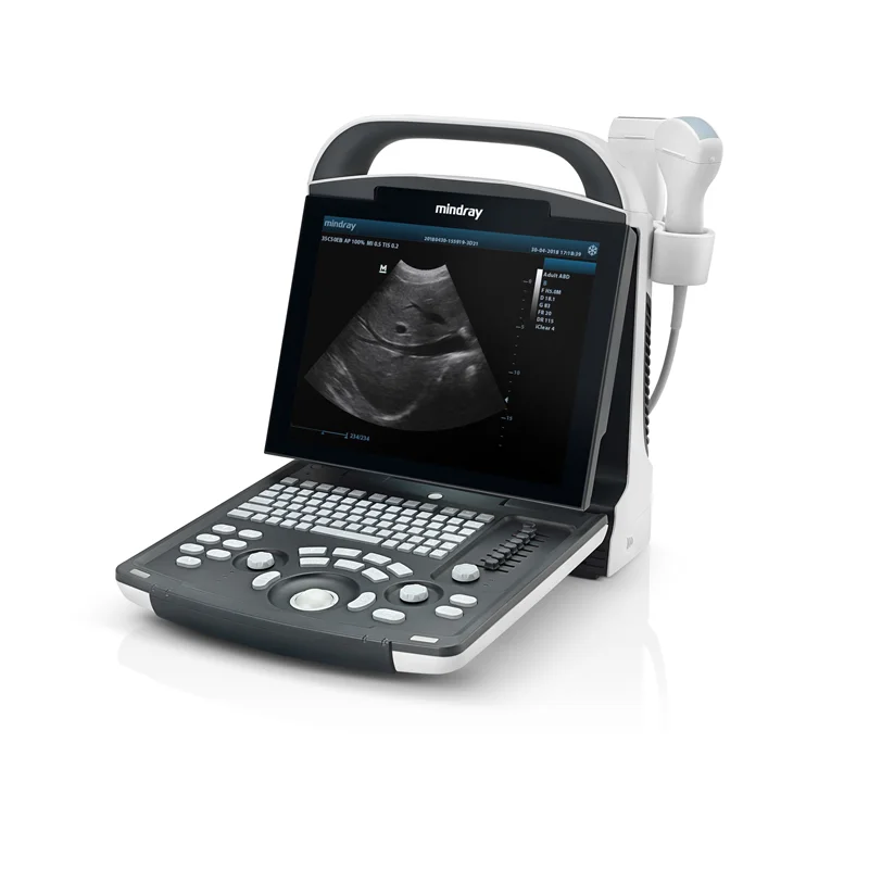 Original Mindray DP-20 Ultrasonic Diagnostic Imaging System Ultrasound Scanner Digital Ultrasound Mindray