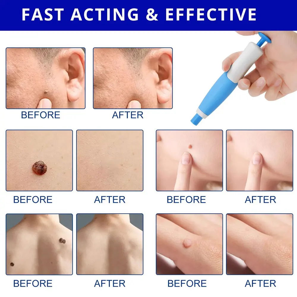 Thumbnail 2 - #16 Best Selling Skin Care Tools