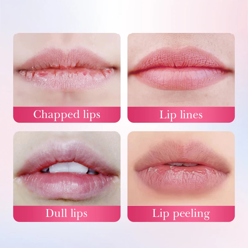 BIOAQUA نيكوتيناميد كريستال الكولاجين قناع الشفاه ترطيب طبطب الشفاه جل أقنعة تبييض ترطيب الشفاه سمنة الشفاه العناية بالبشرة