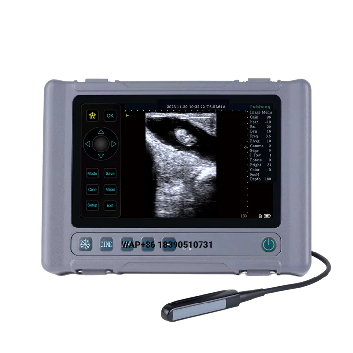 Handheld B-Type Ultrasound Scanner with 8-inch Color  LCD Waterproof 10000mAh Battery 32g Veterinary Storage