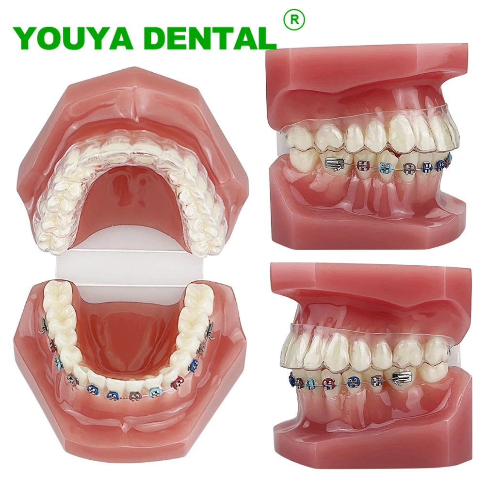 Dental Orthodontic Model With Retainer Invisible Bracket Braces Typodont Teeth Teaching Training Model For Patient Education