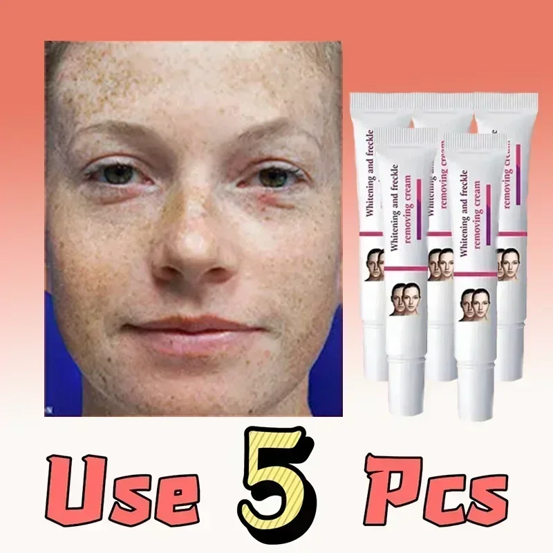 Face Color Control Light Spot Green Cream Remove Freckles Decomposition Melanin Pigment Skin Whitening Hydration Moisturizing