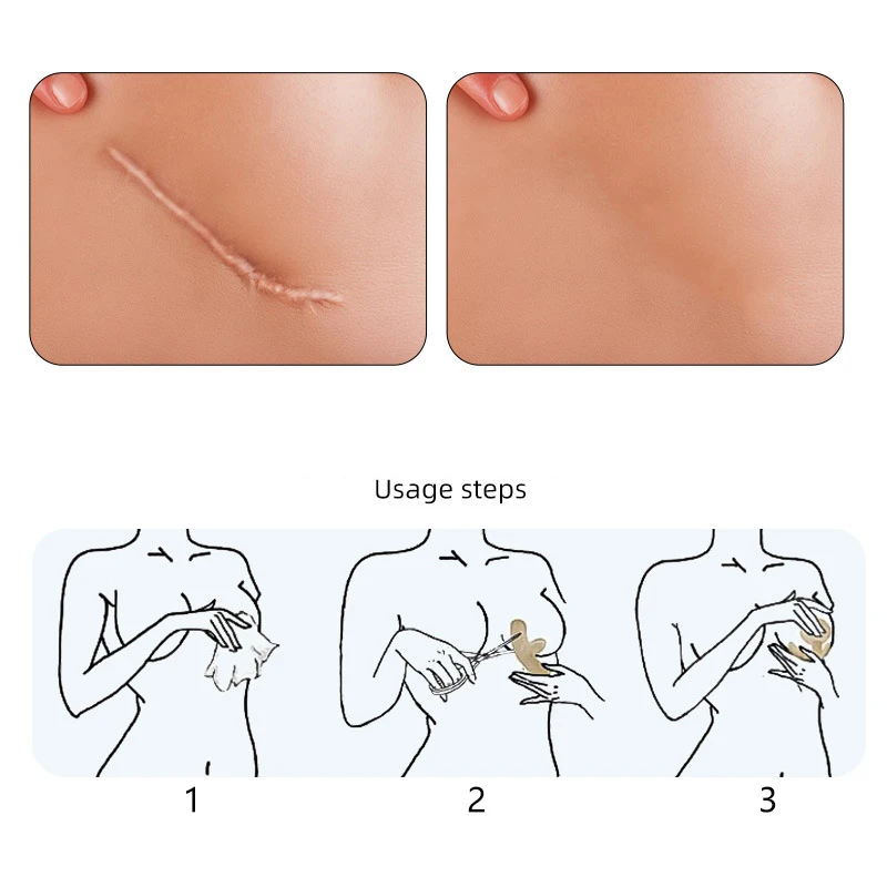 Многоразовые силиконовые гелевые невидимые наклейки, круглая дуга, грудь, невидимый консилер, пластырь для ремонта шрамов, татуировка, недостатки, скрытая лента