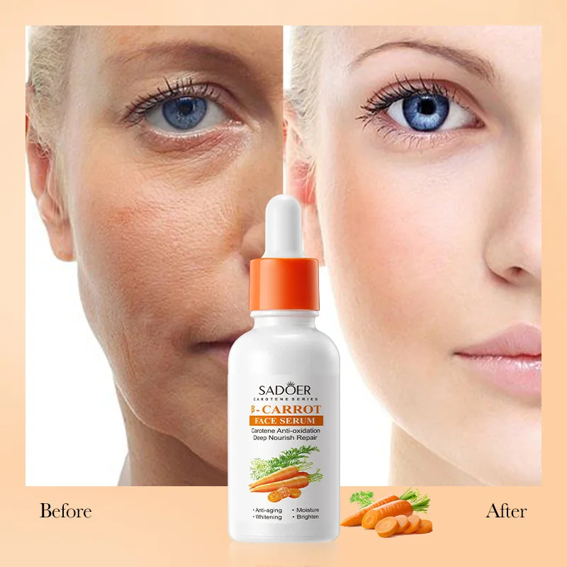 Carrot Whitening Face Serum Dark Spot Corrector Brighten Blemish Freckle Remover Essence Anti-oxidation Anti-aging Skin Care