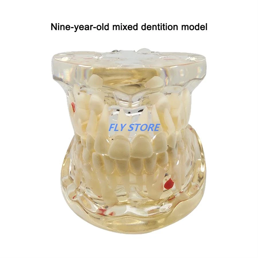 

Dental Model For Children Deciduous Tooth Permanent Teeth Alternating Study Teathing Pediatric Dental Pathology Preventive Model