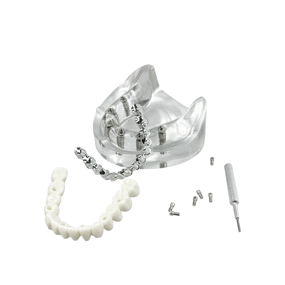 Dental Implant Model with Removable All-on 6 Teeth Screwdriver Tools for Dentist Education Implant Restoration Training