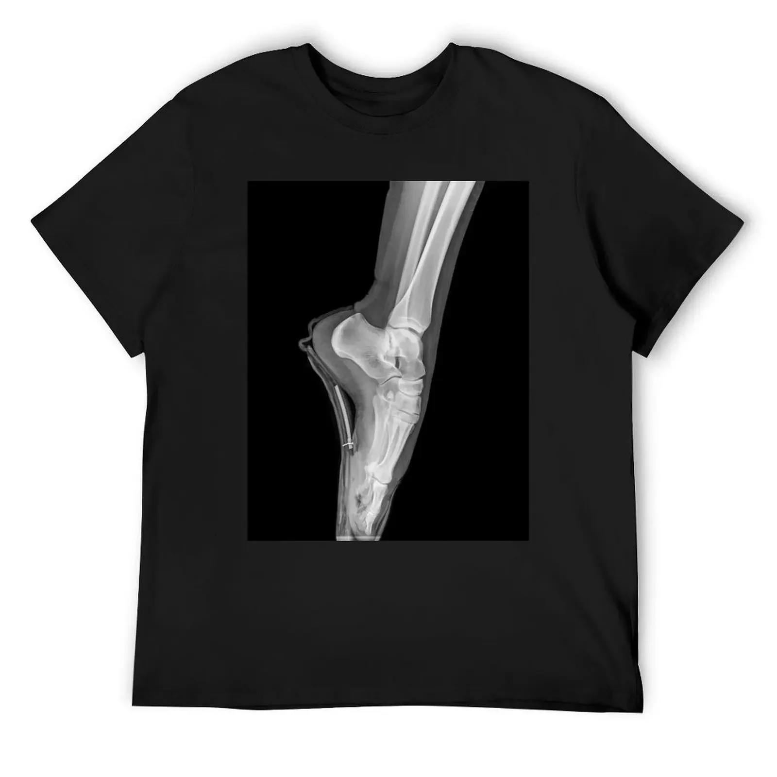 Ballet Dancer x-ray (C022/5235) T-Shirt anime t shirts graphic tee shirt fitted t shirts for men