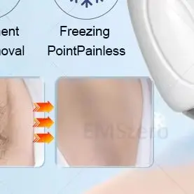 5000W Ice Point Painless Laser Hair Removal Device 755NM 808NM 1064NM 3 Wavelengths Semiconductor Full Body Permanent Removal