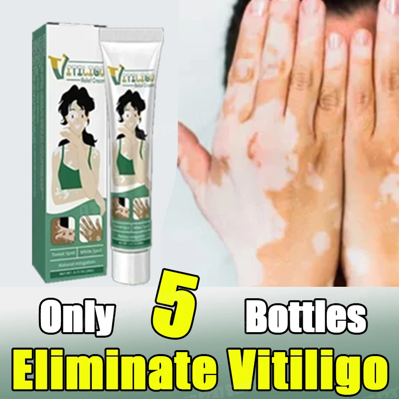 Vitiligo Remove Ringworm White Spot Gel Removal Skin Vitiligo Eliminate Vitiligo External Skin Care Cream