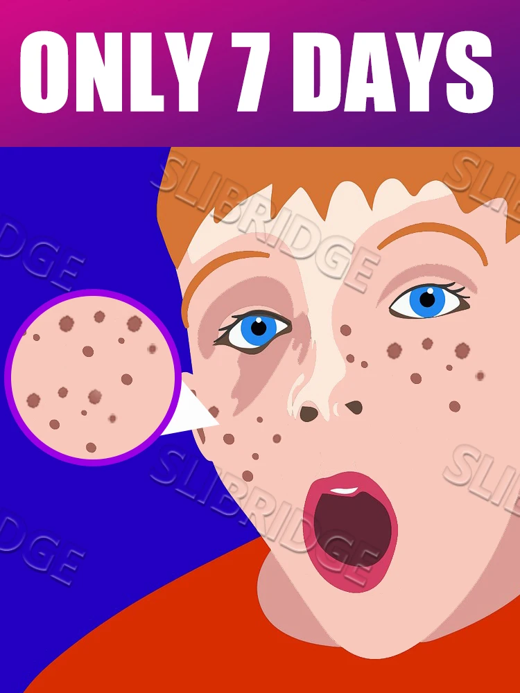 Free shipping,Cleaning Lighten Melasma Tools Dark New Upgrade Spots care Tool,2025 Hot Sale