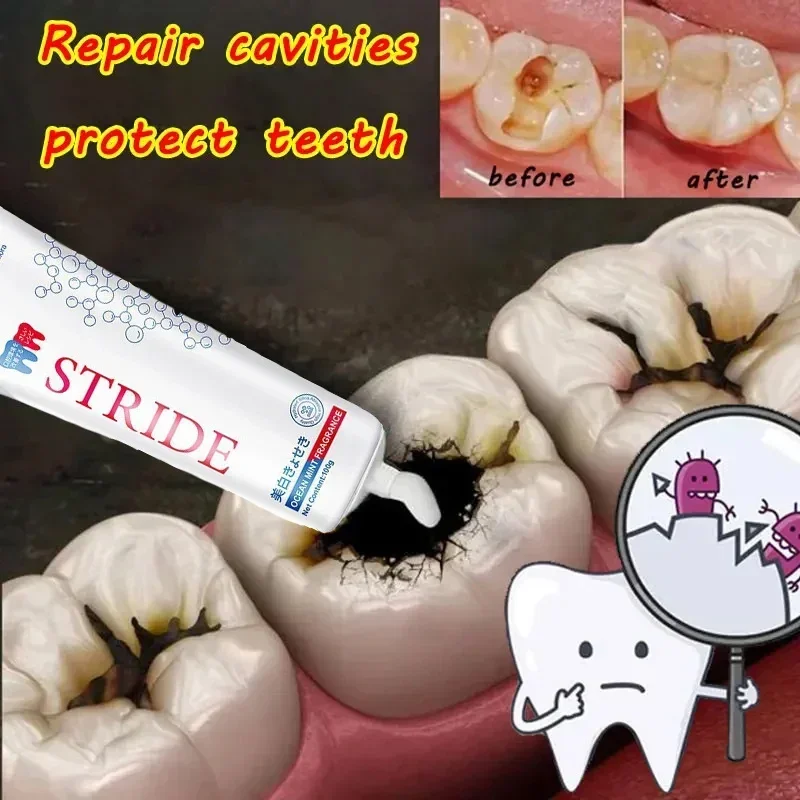 100g Dental Calculus Removal Toothpaste Teeth Whitening Remove Stains Bad Breath Preventing Periodontitis Dental Cleansing Care