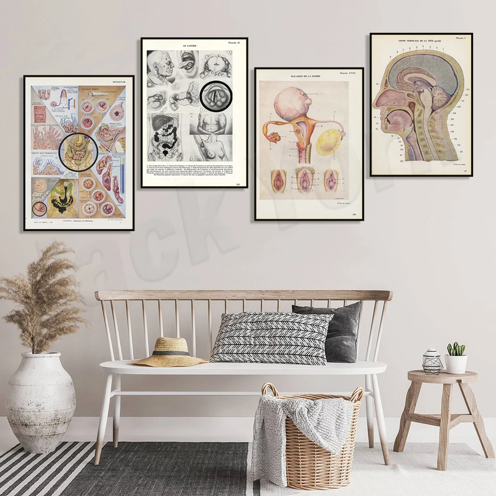 Female genitalia model, intestinal medical anatomy, microcephaly anatomy, psoriasis dermatology poster, doctor medical gift