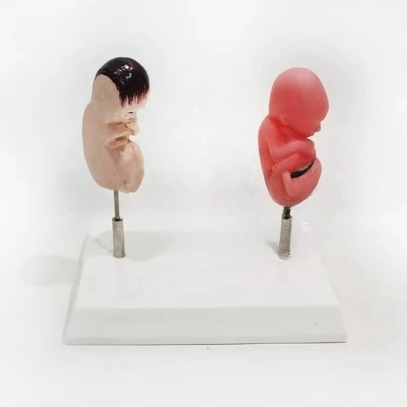 

Medical training model A comparative model between healthy fetuses and smokers