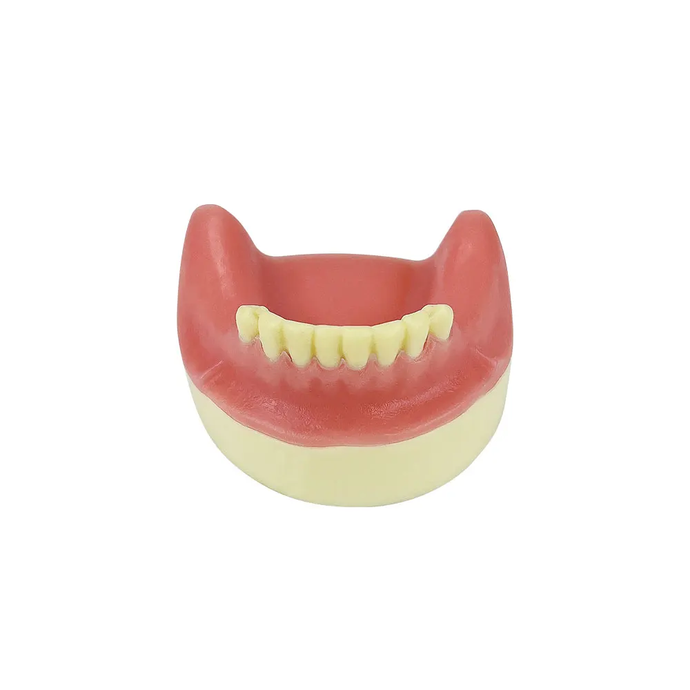 Dental Teaching Model Mandibular Deletion Implant Model for Dentist Student Studying Training Doctor-patient Communication Tool