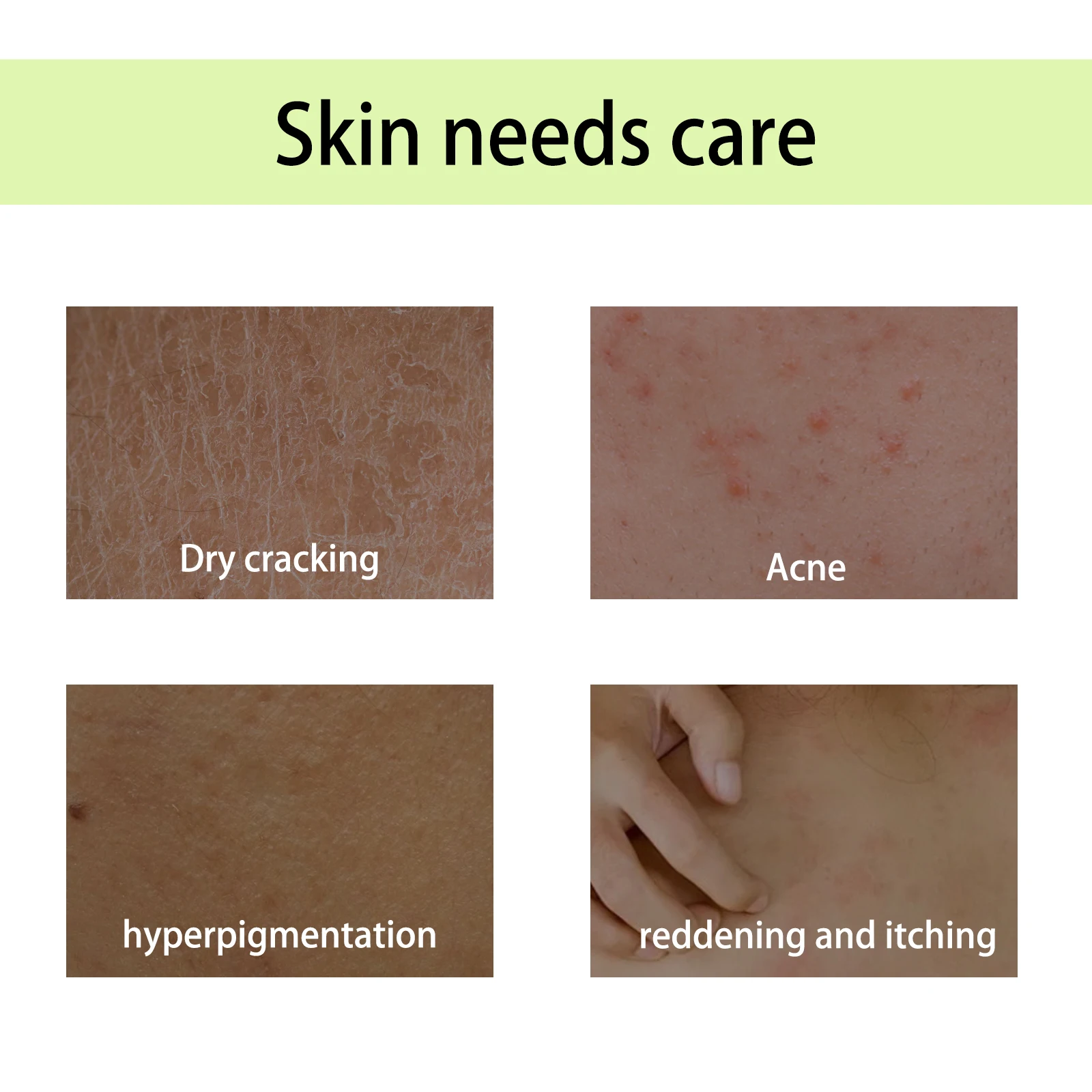 OceAura يدويا زيت الجسم علاج رطبة ثبات الجلد الإغاثة التعب النبات رائحة العلاج العطري النفط 2 قطعة