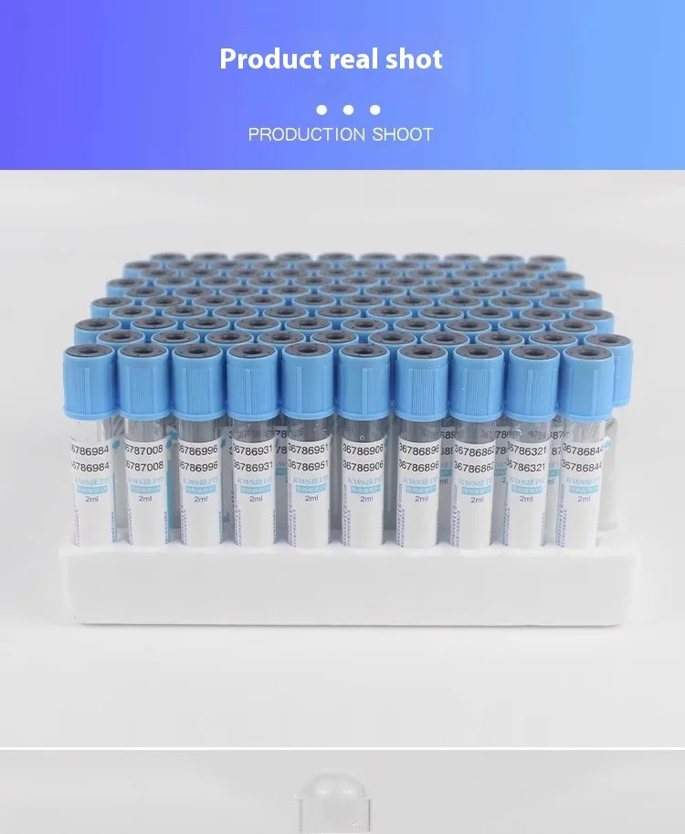 Einweg-Natriumcitrat 1:9 Sterile Vakuum-Blutentnahmeröhrchen 10ml/5ml/2ml Veterinär 100 Stück Kunststoff-Probenentnahmeröhrchen – Detail 3