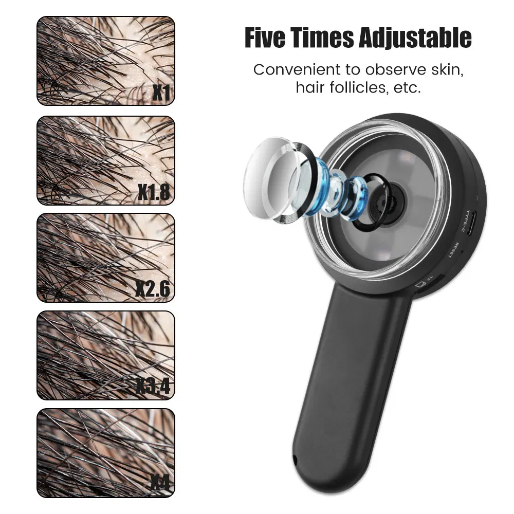피부 분석을 위한 미니 충전식 휴대용 디지털 현미경 - 휴대용 8 LED 배율 피부경 및 피부 분석기