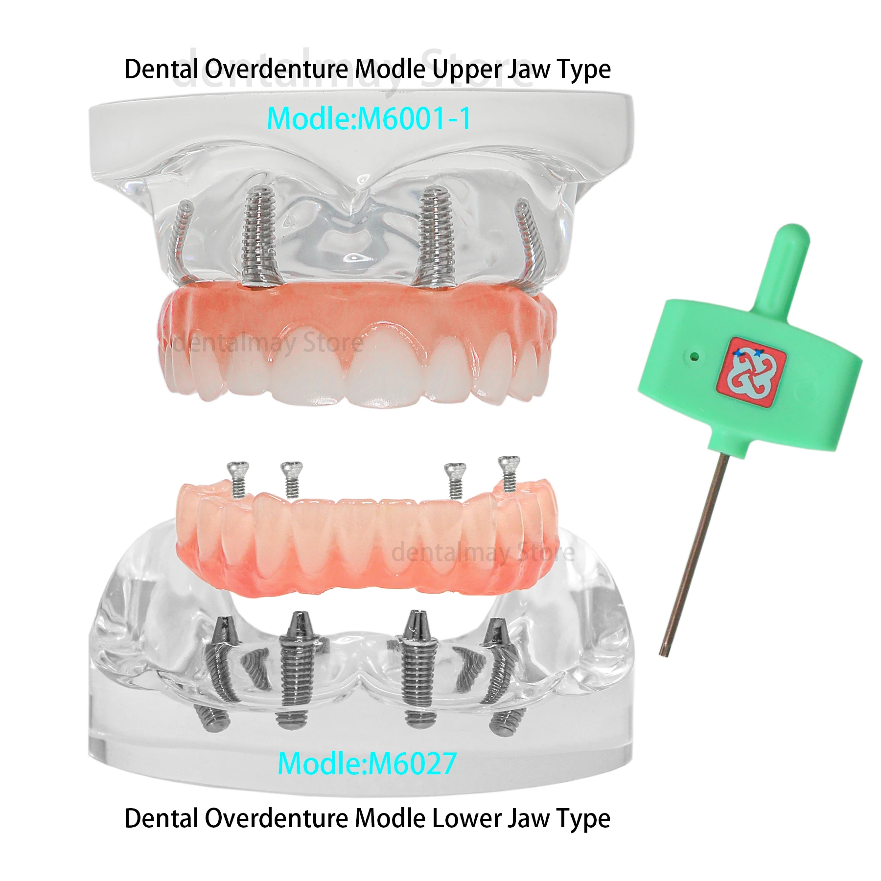 Implant Teeth Model Upper Lower Jaw Type All on 4 Overdenture Modle Transparent With 4 Removable Screws