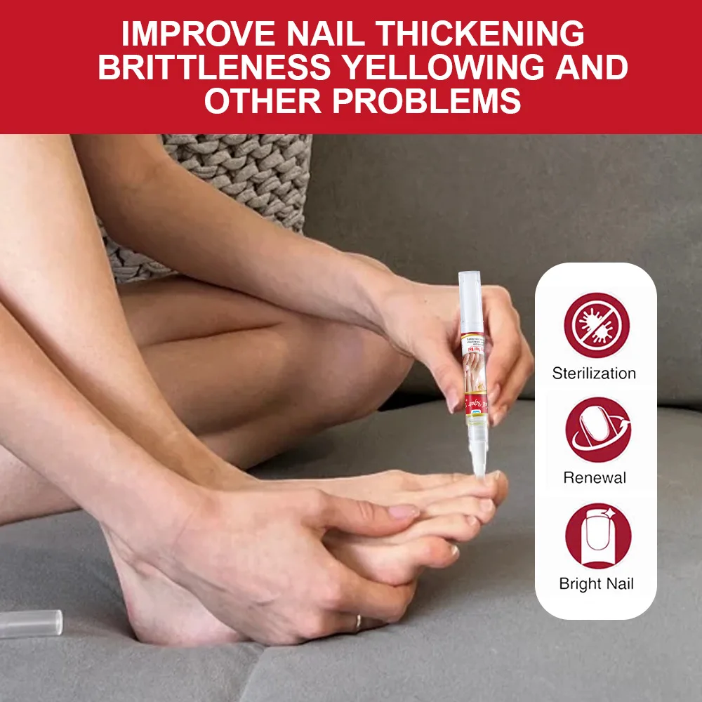 真菌性爪治療血清爪真菌除去治療爪周囲炎液体抗灰色爪足指感染症足修復ケアツール
