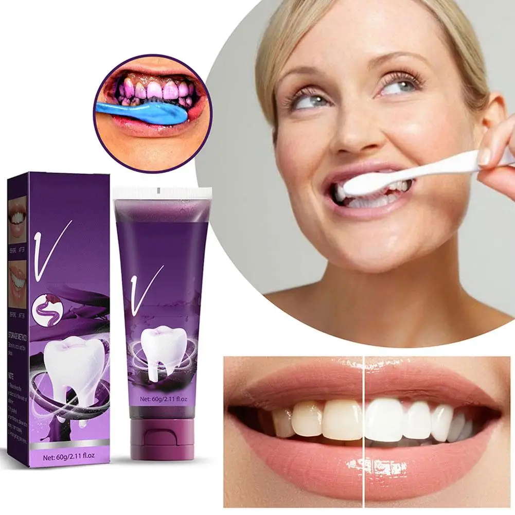 Creme dental brilhante roxo V34, remover o tártaro, manchas amarelas, dentes brancos, boca limpa dental, placa dentária, B7a2