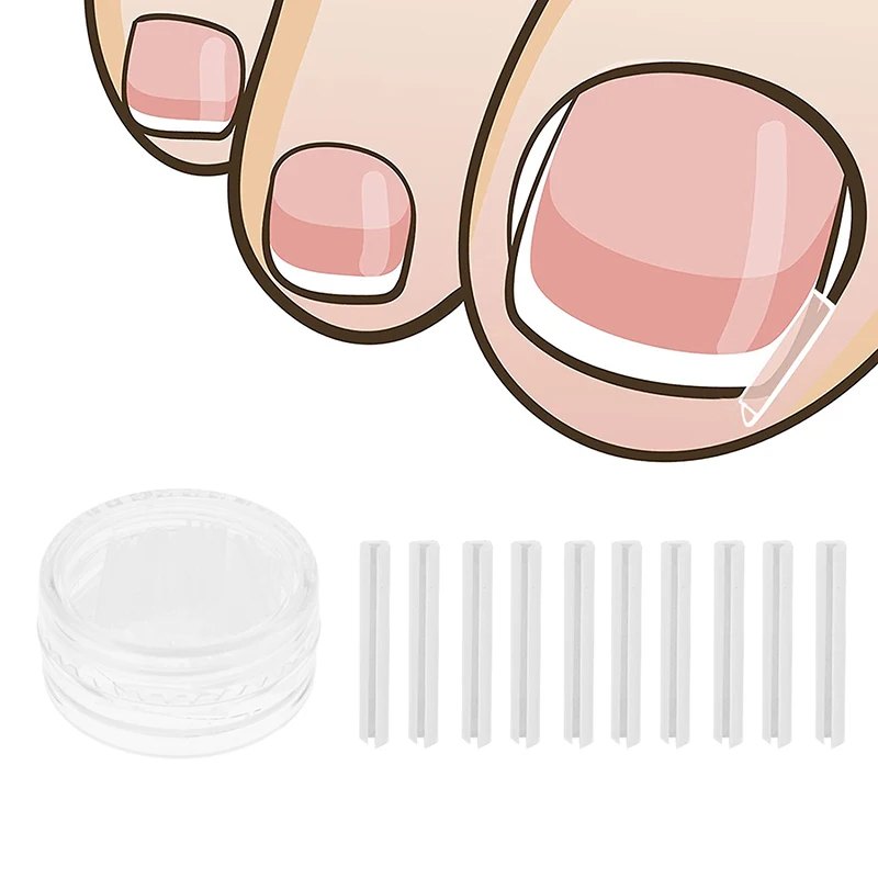 50Pcs Ingrown Toenail Correction Tool Ingrown Toe Nail Treatment Elastic Patch Sticker Straightening Clip Brace Pedicure Tool