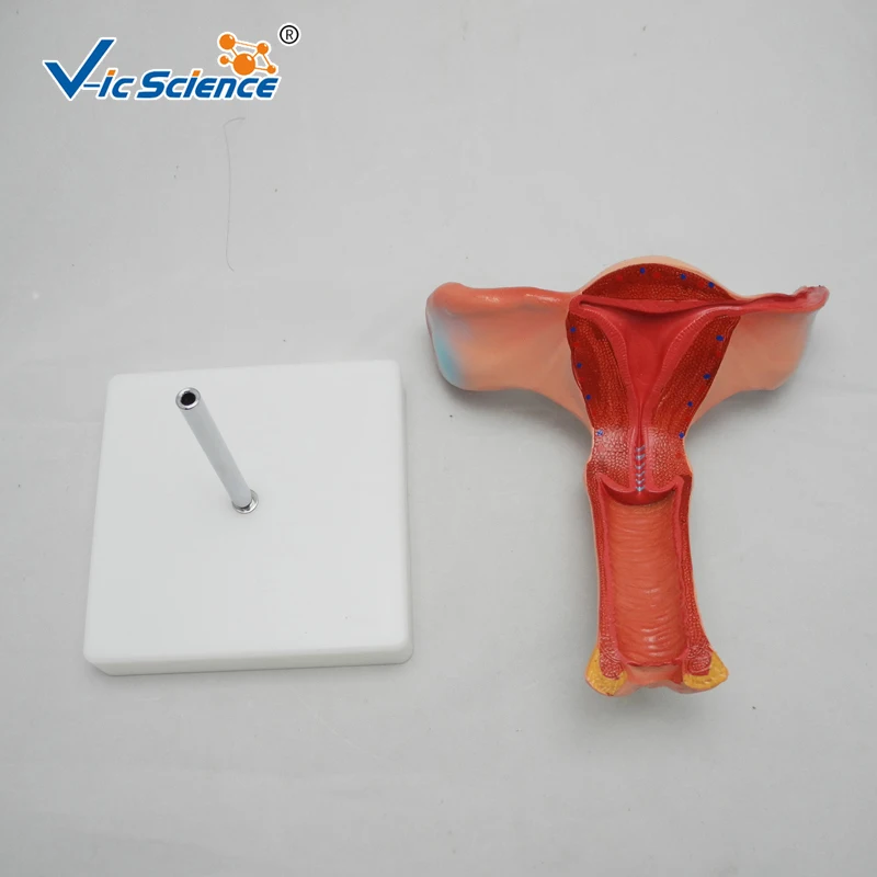 Advanced PVC Made Magnified Uterus Enlarged Model