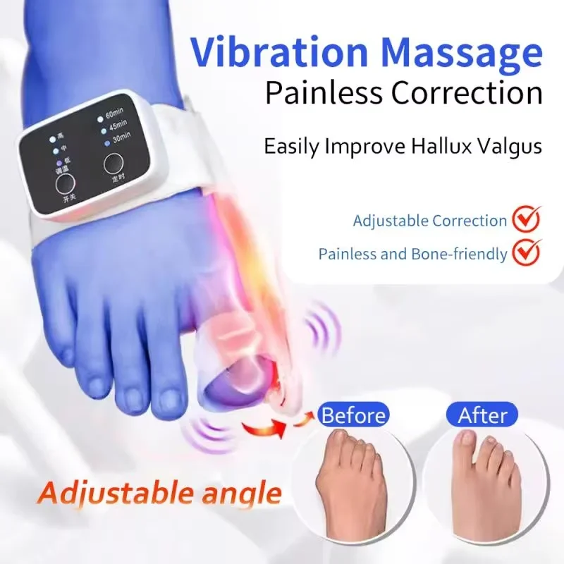 

Electric Hallux Valgus Bunion Corrector Vibration Massage Painless Correction Easily Improve Toe Corrector Straighten Adjustable