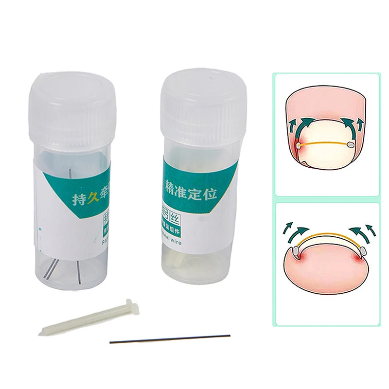 

New Ingrown Toenail Corrector Tools Pedicure Recover Embed Toe Nail Professional Ingrown Toenail Straightening Clip Brace
