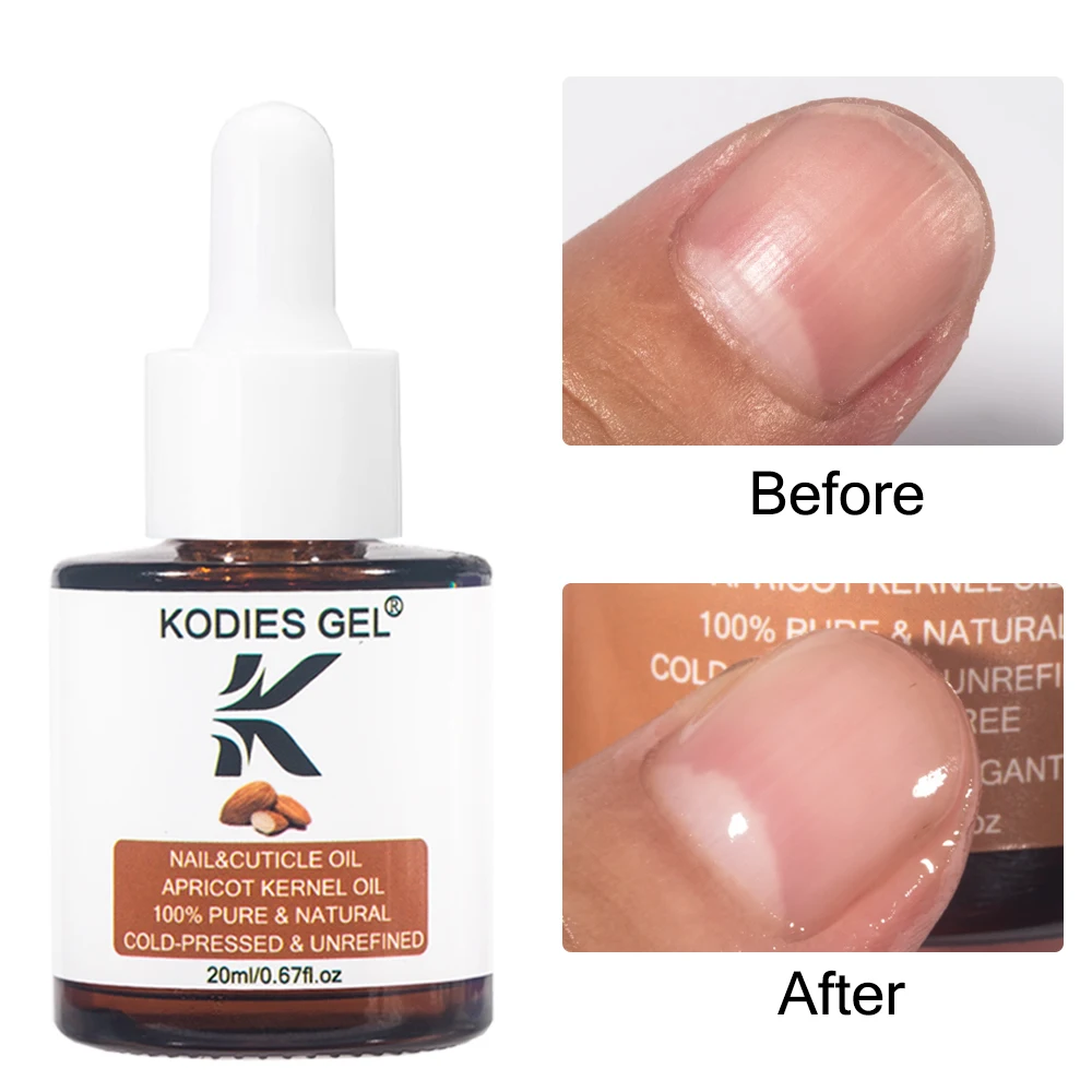 Kodies Gel Mandel Nagel Nagel haut Öl Aprikose Bio Nail Art Behandlung Serum für beschädigte Nägel 20ml kalt gepresste unraffinierte Öle