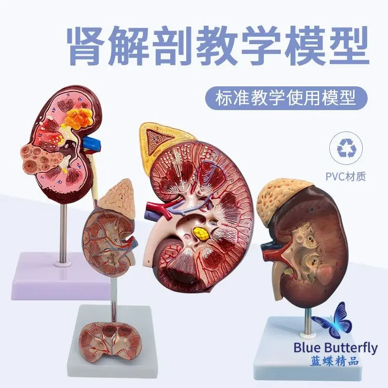 

An Enlarged Anatomical Model Of The Human Kidney, A Cross-sectional Anatomical Model Of The Kidney, And A Structural Model