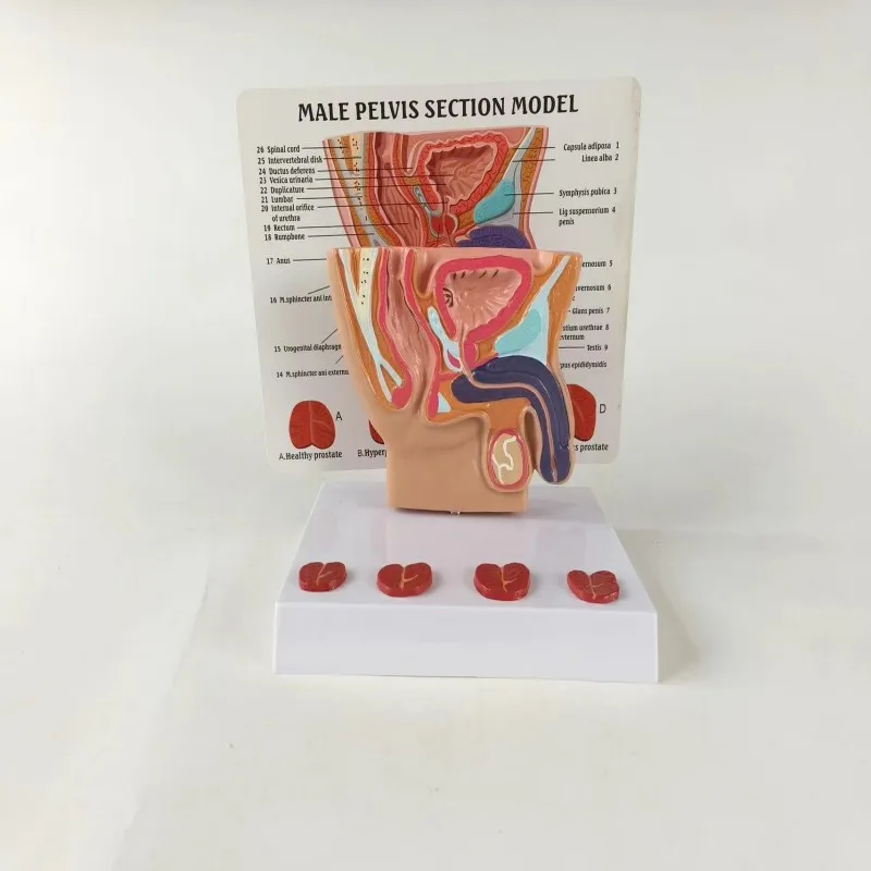 

Human Male Prostate Anatomy Male Genitals Abdominal Cavity Anatomy Testis Bladder Bowel Teaching Instrument for Human Body