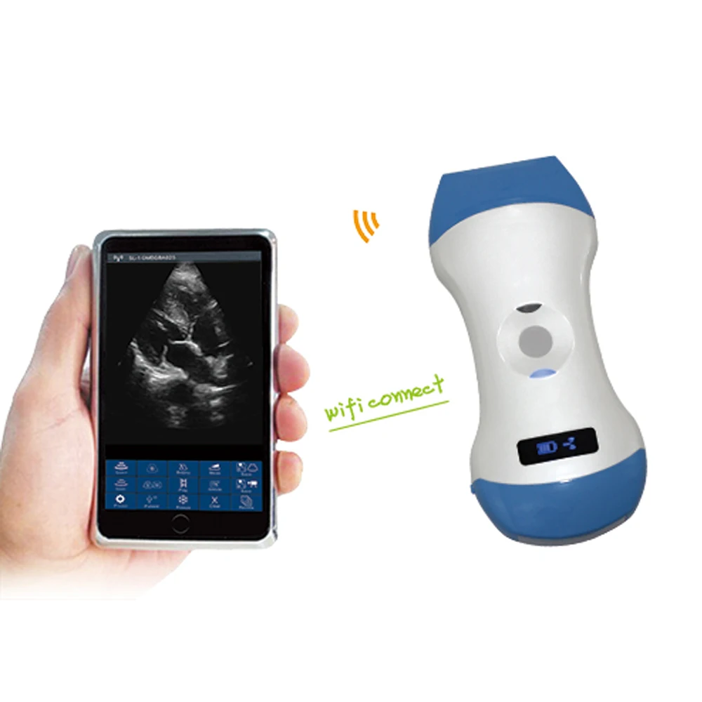 Wifi Probe 3 in 1 Wireless Ultrasound Scanner Color Doppler Convex/Linear/Phased array