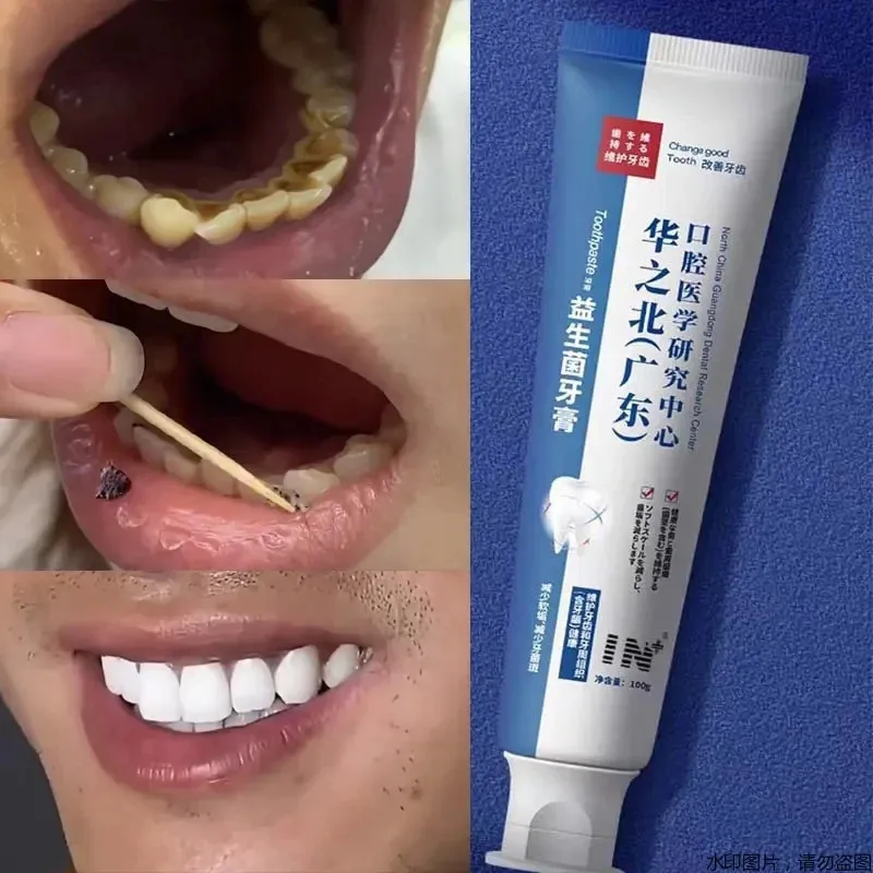 

Quick Repair of Cavities, Caries, Filling, Removal of Plaque, Stains, Decay Whitening Yellowing Repair Teeth Teeth Whitening100g