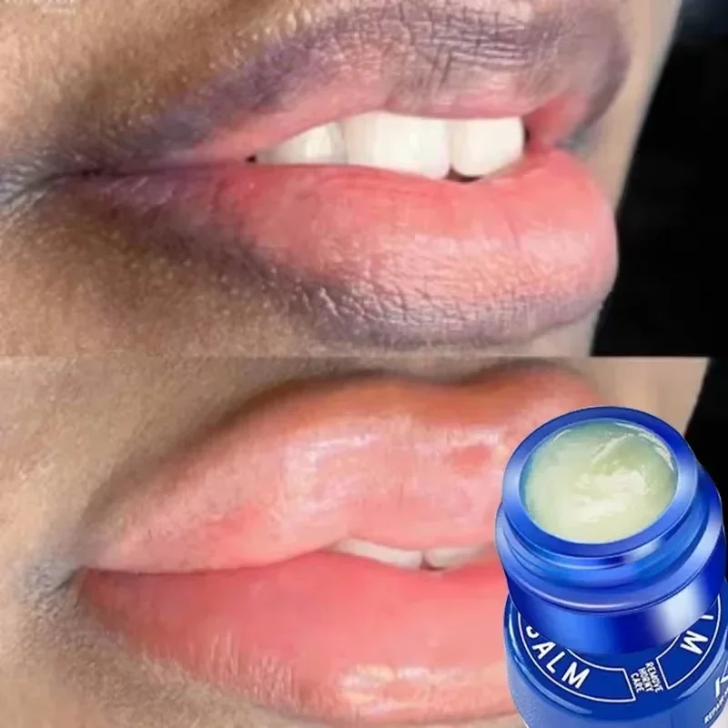 Rimuovi il balsamo per le labbra scuro schiarire la melanina maschera per le labbra nutriente a lunga durata Lip Waterproof idratante Anti-dry