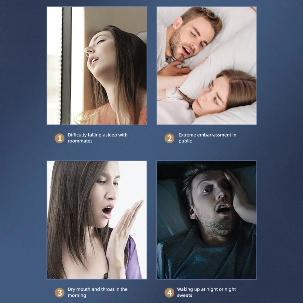 Electric Anti Snoring Aid For Heavy Snorers 3 Speed Adjustment 12g Ultralight For Better Sleep