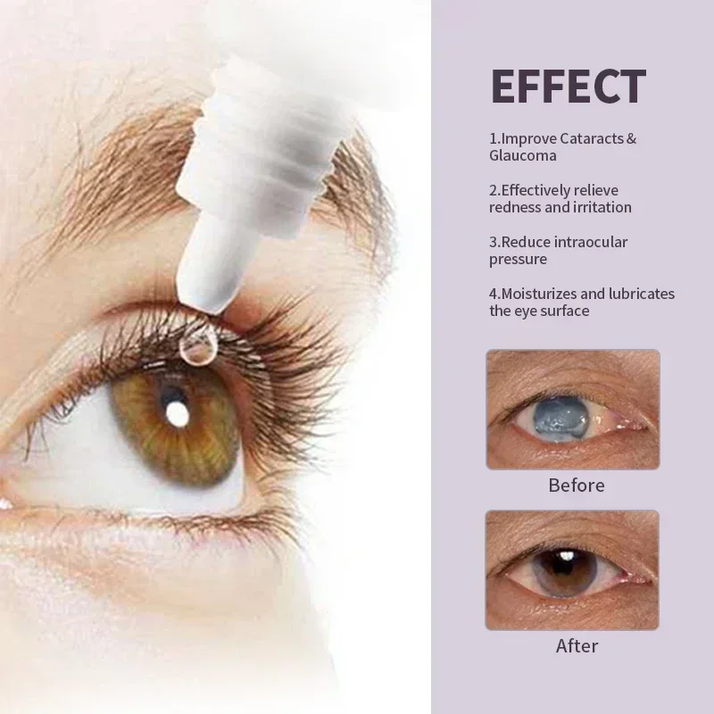 3/5Bottles Cataract Treatment Eye Drops For Dry Itchy Eyes Pain Fatigue Removal Blurred Vision Cleaner Germany Medicine