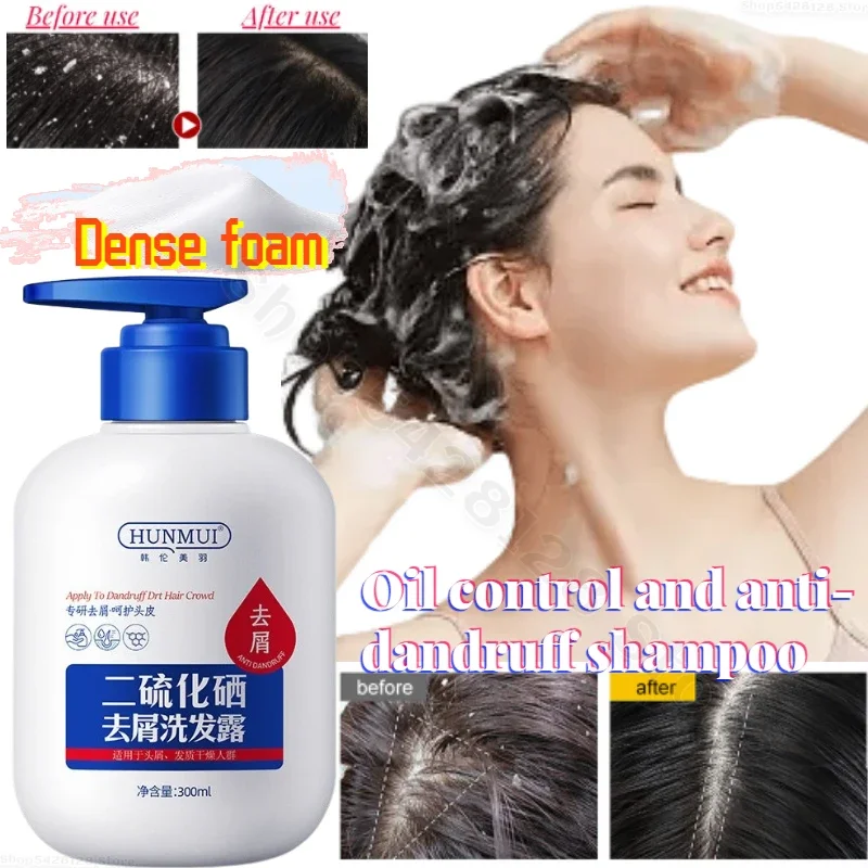 Herbal Extract Anti-dandruff Shampoo Nourishes and Repairs Damaged Hair Follicles Anti-dandruff Anti-itch Hair Care Shampoo