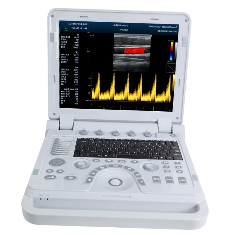 Vet Display Depth ≥300 Mm Veterinary Ultrasound For Sheep Farm Animal Pregnant Test Animal Care And Supplies