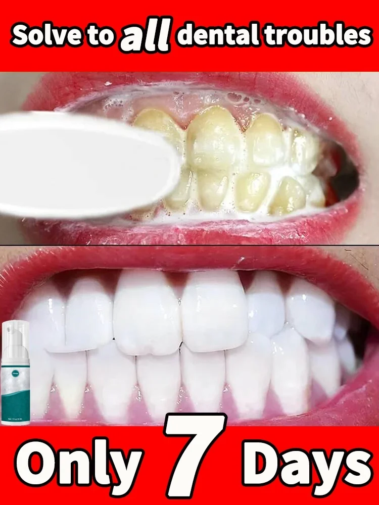 

100% natural tartar removers dissolve tartar and remove stains