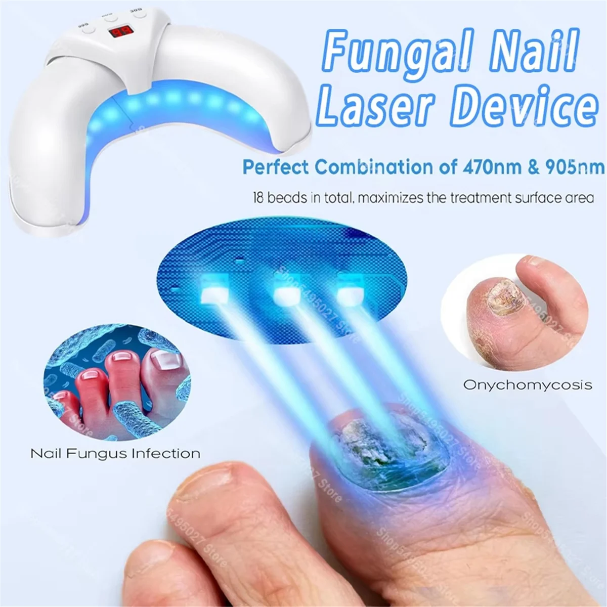 ABUYNail Fungus Laser Treatment Device Fingernail Fungus Treat Onychomycosis Effectively Remove Onychomycosis Grow Toe Nail