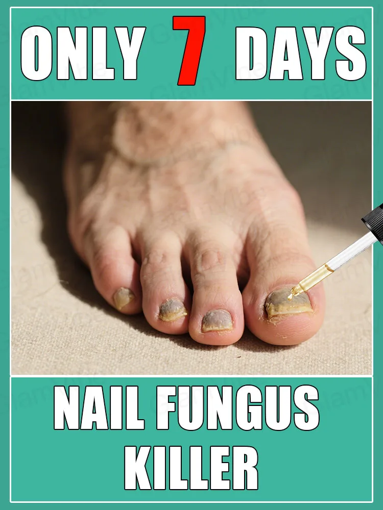 

Iɴsᴛᴀɴᴛ Eғғᴇᴄᴛ! Fᴜɴɢᴀʟ Nᴀɪʟ Essᴇɴᴛɪᴀʟ Oɪʟ, Tᴀʀɢᴇᴛɪɴɢ ᴛʜᴇ Rᴏᴏᴛ ᴏғ Fᴜɴɢᴜs,