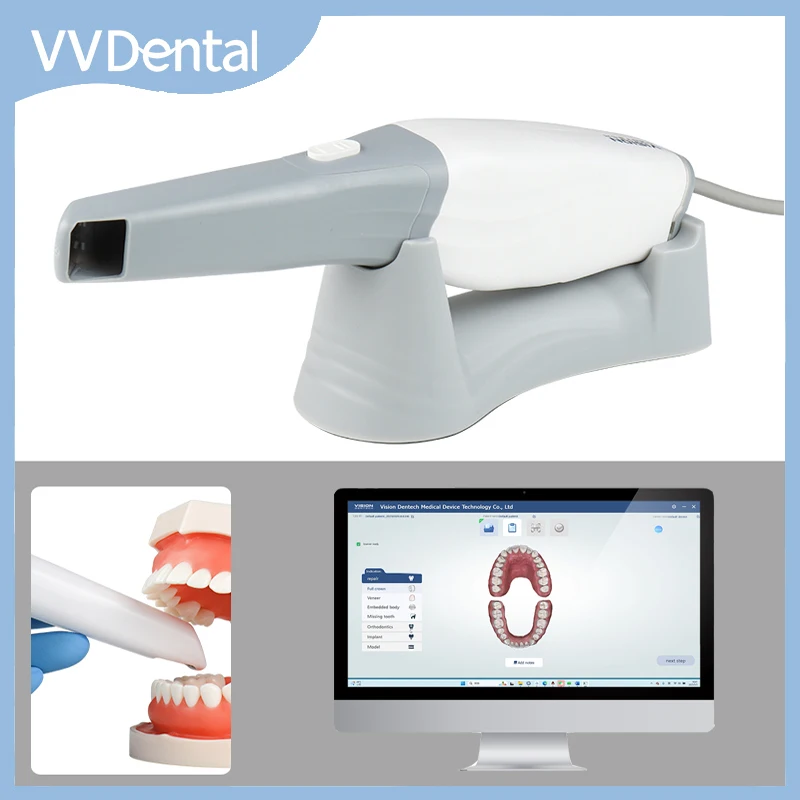 VVDental 3D Intraoral Scanner Digital Imaging Scanner with Friendly Software and Ortho Simulation Dental Impression Device