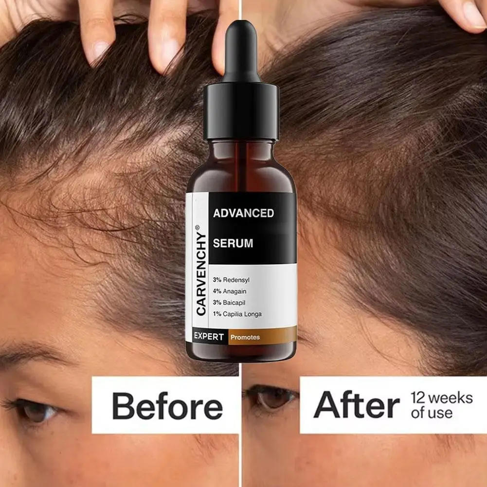 Meisaar-tratamiento de cabello orgánico 100% de etiqueta privada, suero de aceite para el crecimiento, biotina, romero, arroz hidratante para hombres y mujeres