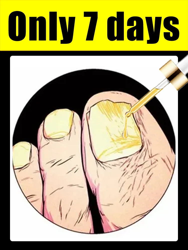 

Новые инструменты для чистки ногтей и маникюра 2026 года, инструменты для ухода за ногами 2025 года, хит продаж