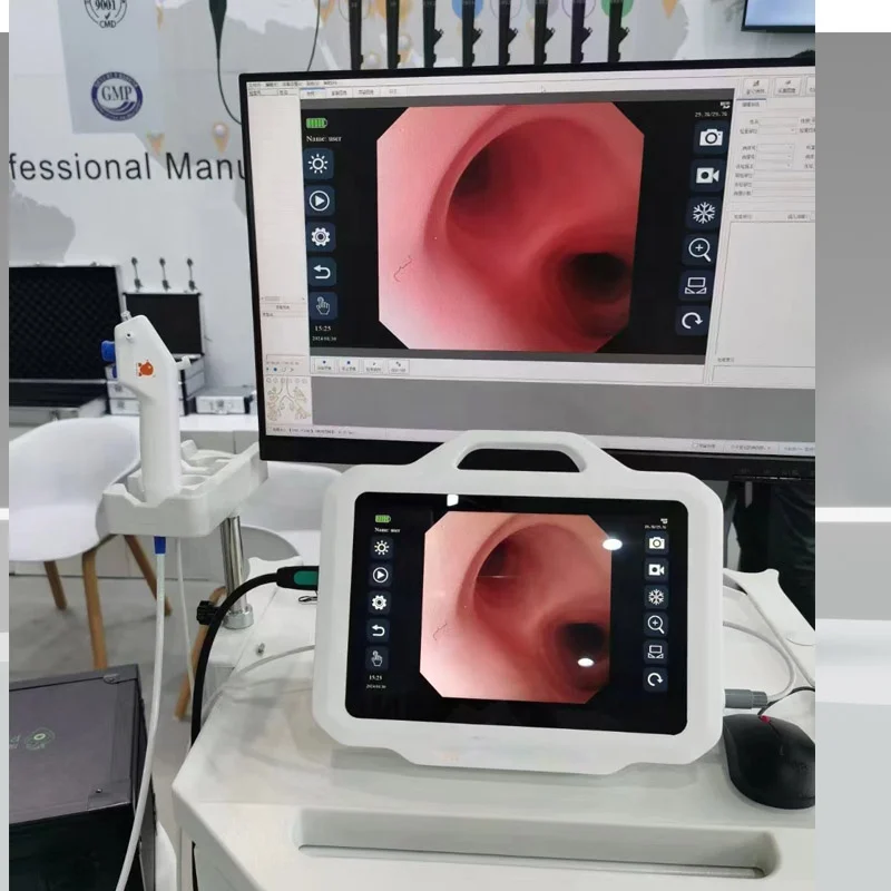 Advanced Reusable Flexible Video Bronchoscope System for Respiratory Diagnosis