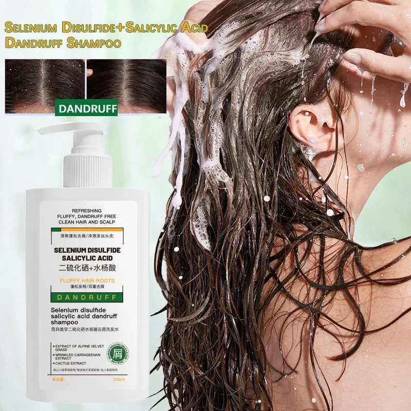 

Anti Dandruff Shampoo 200ml Scalp Exfoliating Oil Control Selenium Sulfide Salicylic Acid Fresh Feeling