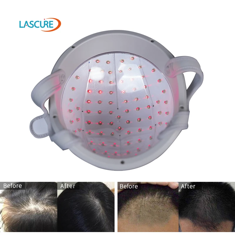 Wholesale LLLT Laser Helmet 650nm Red Light Therapy Cap With 82 Diodes OEM ODM Hair Growth Head Massage Hair Care Solution