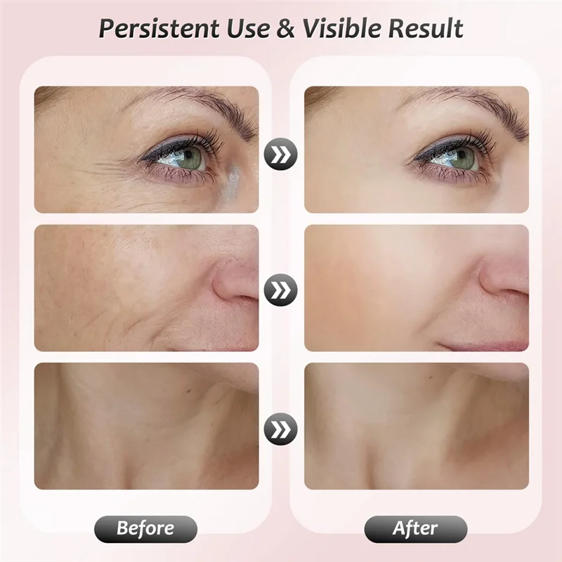 A24P Face And Neck Massager Face And Neck Red Light Therapy Home Facial Skin Care Tools