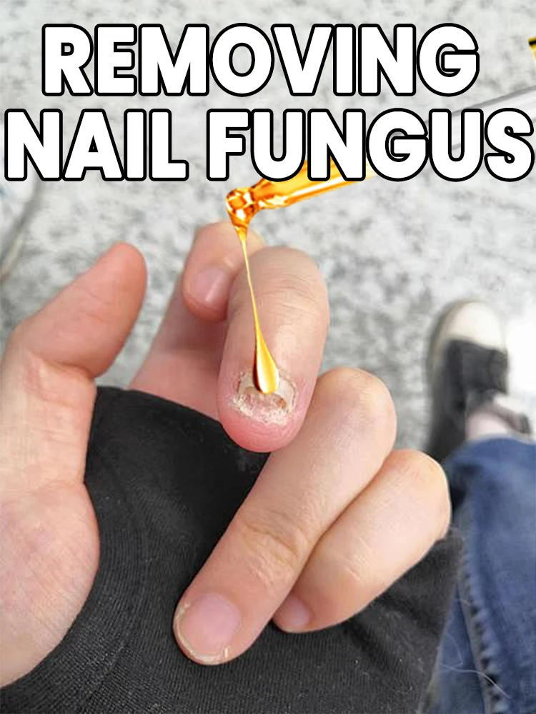 

The mostpowerful black technology in 2025! solve the nail problem!